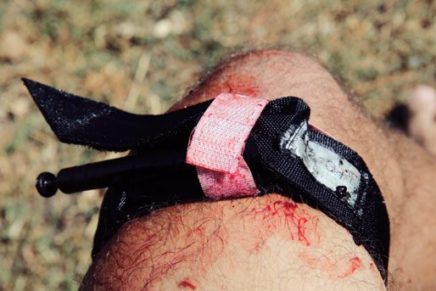 sich-turniket-photo-19-436x291